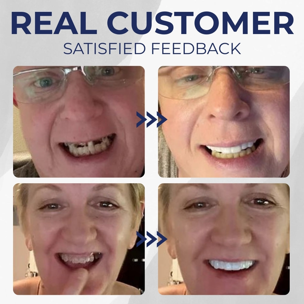 Glowesa™ Denture Kit