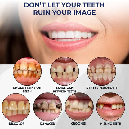 Glowesa™ Denture Kit